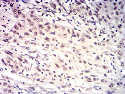 HTRA2 Mouse mAb[63757]