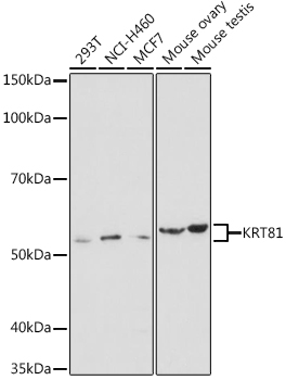 KRT81 Rabbit Polyclonal Antibo