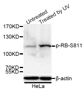 RB(Phospho-Ser811) antibody[12