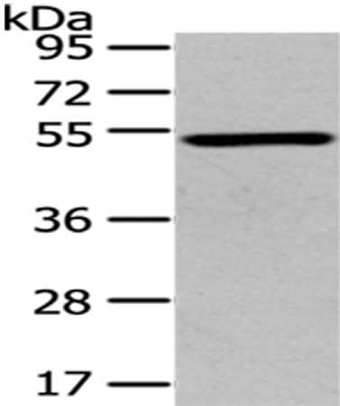 TSPYL1 Antibody[43171]