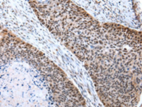 POLE3 Antibody[43062]