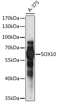 SOX10 Rabbit Polyclonal Antibo