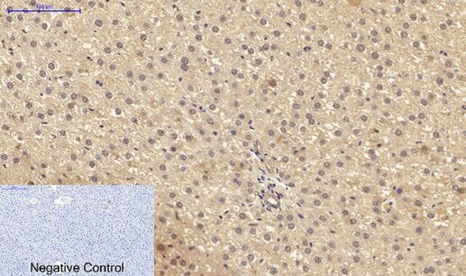 PKC Polyclonal Antibody[41347]