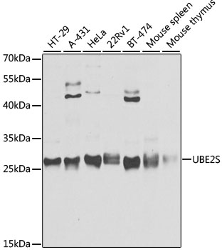UBE2S Rabbit Polyclonal Antibo