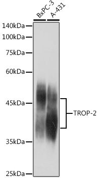 TACSTD2 Rabbit Polyclonal Anti