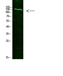 COL19A1 Polyclonal Antibody[46