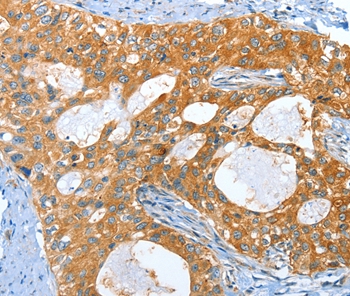 AMHR2 Antibody[36093]