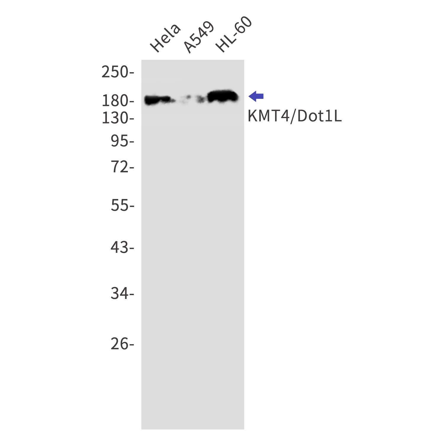 KMT4 Rabbit mAb[52788]