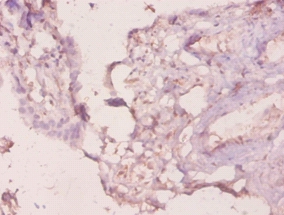 Galectin-3 Polyclonal Antibody