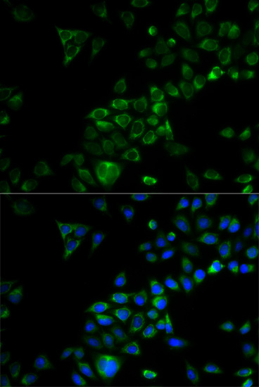 TRAF3 antibody[38574]