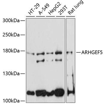 ARHGEF5 Rabbit Polyclonal Anti
