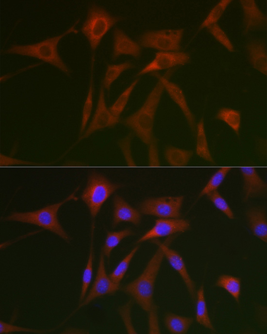 STAT5A Rabbit Polyclonal Antib