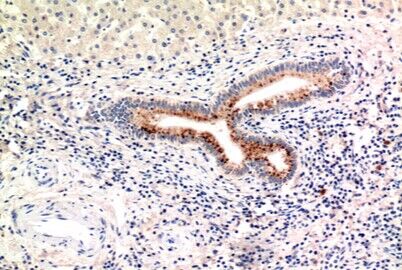 C4a/b Polyclonal Antibody[4190