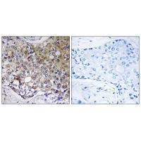 ATG4A Antibody[34631]