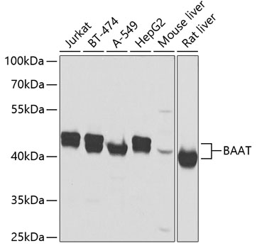 BAAT Rabbit Polyclonal Antibod