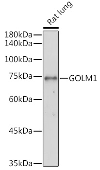 GOLM1 Rabbit Polyclonal Antibo