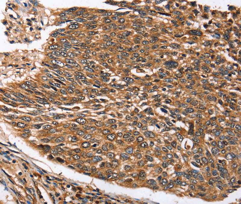 STC1 Antibody[40121]