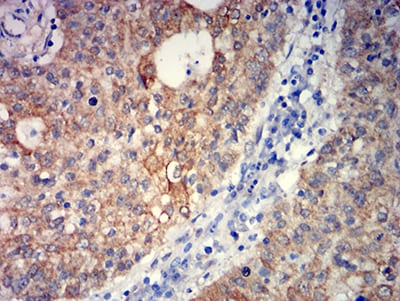 GRM5 Mouse mAb[63698]