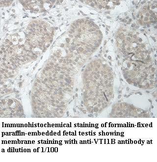 VTI1B Antibody[39966]