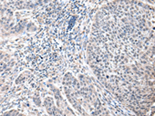ZFP64 Antibody[42872]