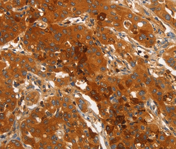 ORM2 Antibody[36251]