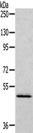 RCC1 Antibody[43140]