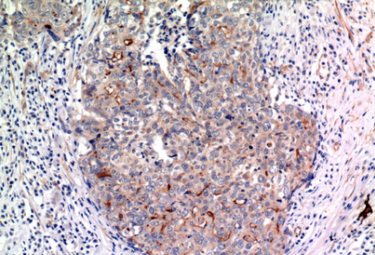 Mucin 1 Polyclonal Antibody[41