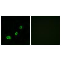 ACOT1 Antibody[34379]