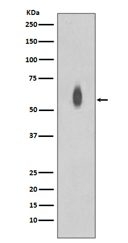 c-Myc (Phospho-Thr58/Ser62) Ra