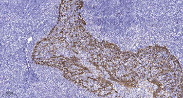 GPR135 Polyclonal Antibody[442