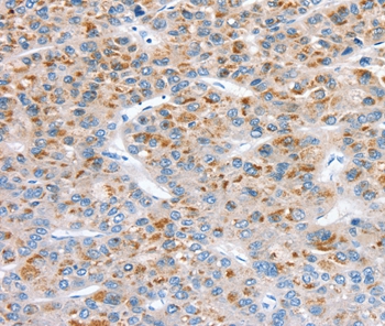 SOD4 Antibody[37969]