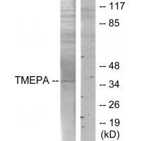 TMEPA Antibody[34019]