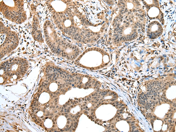 HIF1AN Antibody[42894]