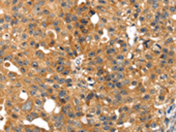 SMYD4 Antibody[42762]