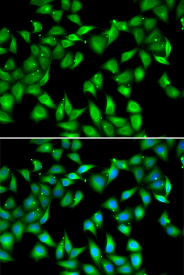 MYL3 antibody[39082]