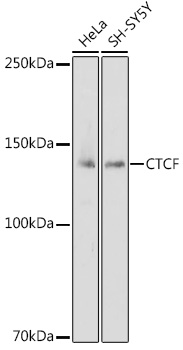 CTCF antibody[38199]