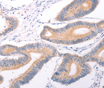 TRPC7 Antibody[35976]