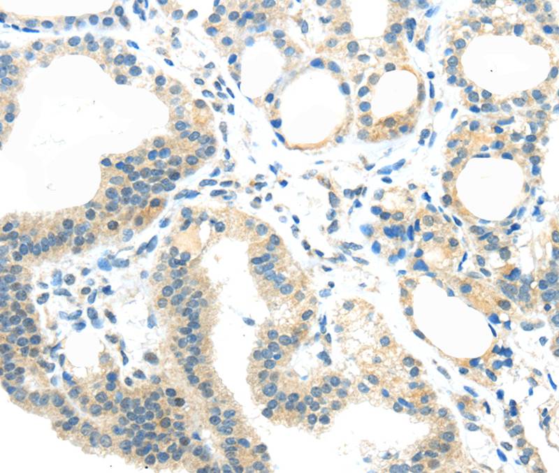 AEBP1 Antibody[40358]