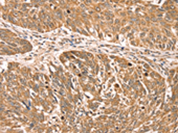 RPLP2 Antibody[42743]
