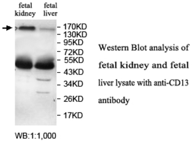 CD13 Antibody[39696]