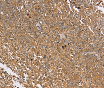 PTPN20B Antibody[37850]