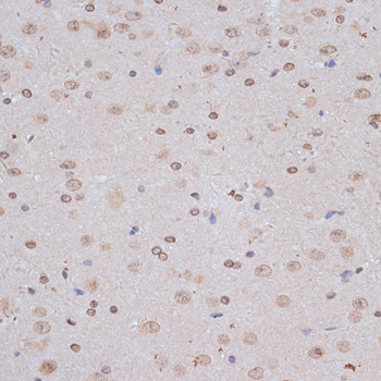 NFE2L1 Polyclonal Antibody[291