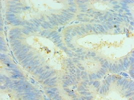 CLIC4 Polyclonal Antibody[4212