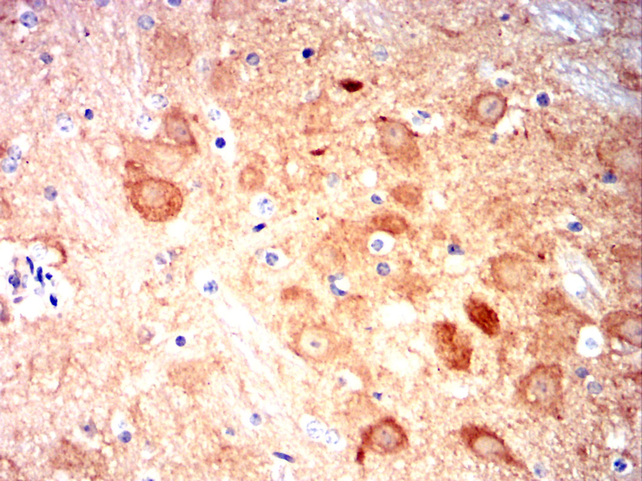 CAMK2G Mouse mAb[63190]