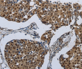 PRKAR1B Antibody[37215]