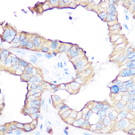 CD47 Rabbit Polyclonal Antibod