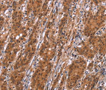 SLC8A2 Antibody[37177]