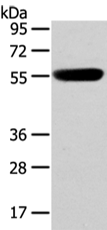 CBX4 Antibody[43446]