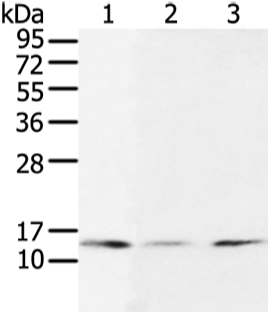 UBE2I Antibody[43252]