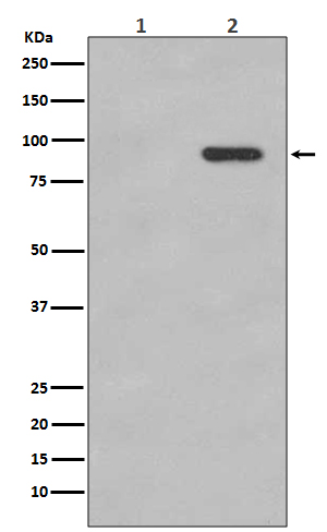 beta Catenin (Phospho-Ser33/Se